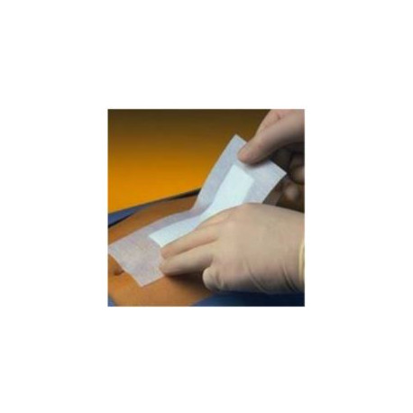 PRIMAPORE ADHESIVE DRESSING