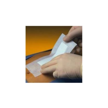 PRIMAPORE ADHESIVE DRESSING